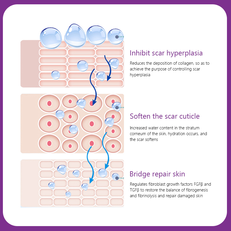 Customize Logo Acne And Dark Spot And Scar Removal Cream Stretch Mark Cream