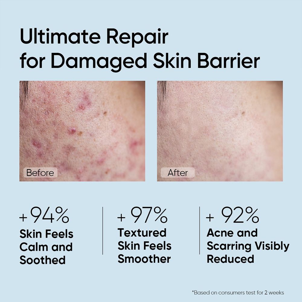 Anti Acne Ceramide Skin Barrier Repair Serum