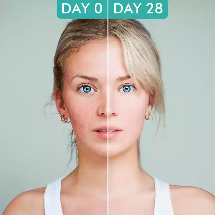 Organic Anti Aging Wrinkles 2.5 % Active Retinol Vitamin E Moisture Face Cream