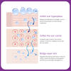 Customize Logo Acne And Dark Spot And Scar Removal Cream Stretch Mark Cream