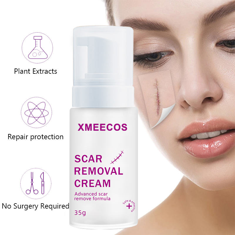 Customize Logo Acne And Dark Spot And Scar Removal Cream Stretch Mark Cream