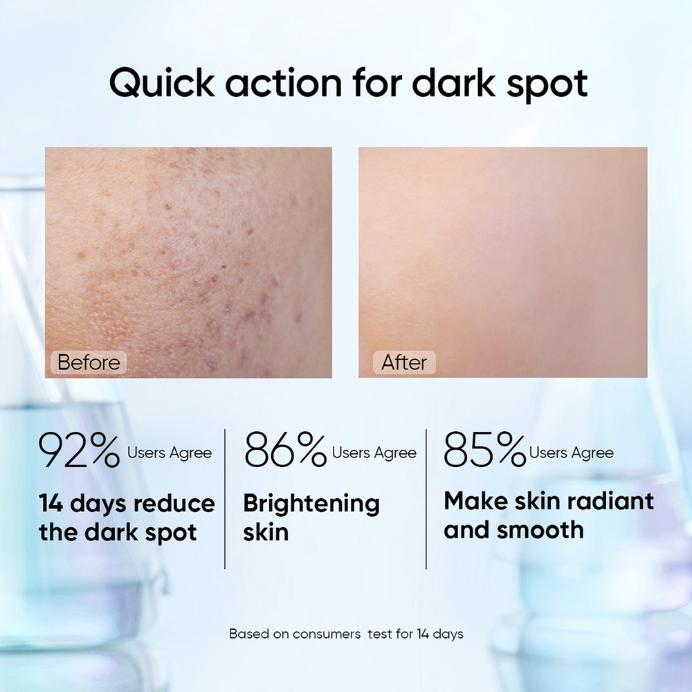 Wholesale Dark Spot Remover Repairing Niacinamide Face Serum