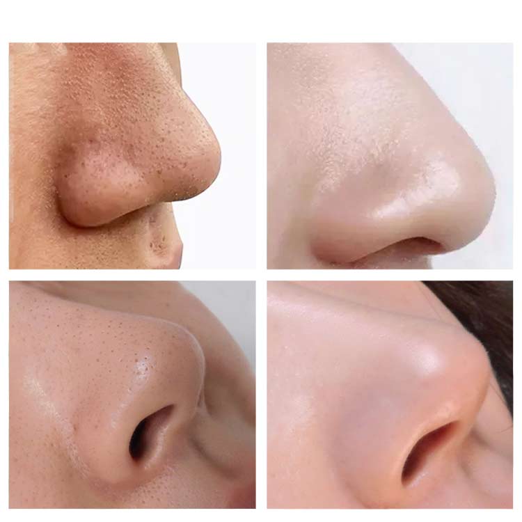 Blackhead Deep Cleansing 24k Gold Mask Peel Off Face Mask