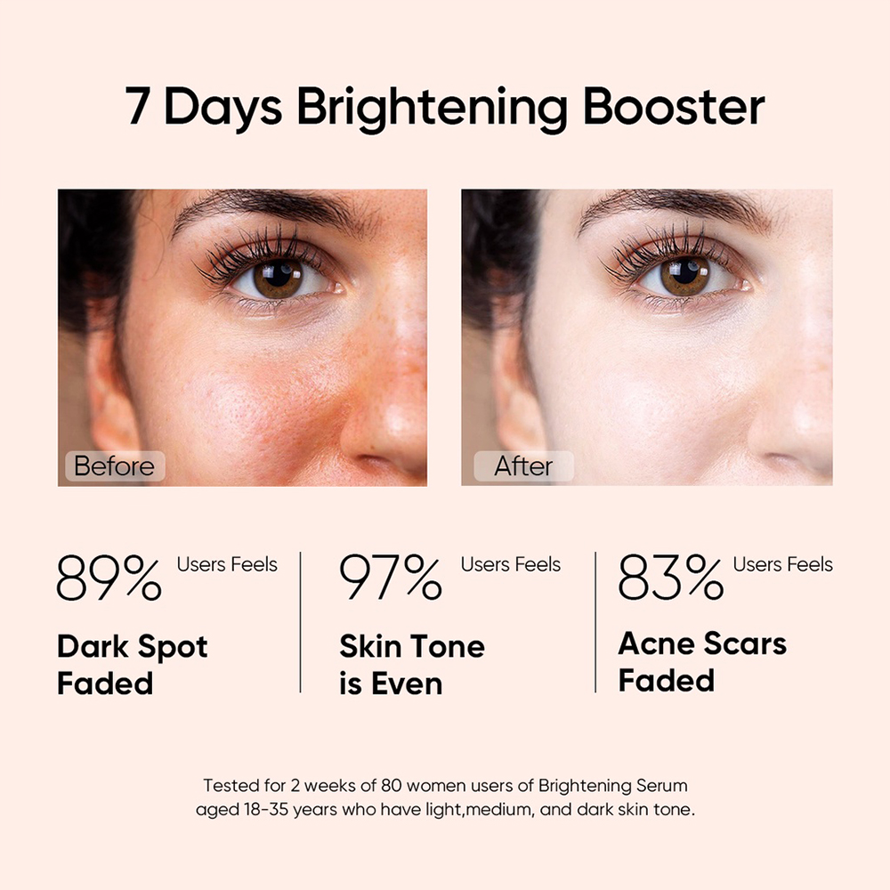 Fade Dark Spot Niacinamide Brightening Vitamin C Serum