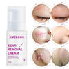Customize Logo Acne And Dark Spot And Scar Removal Cream Stretch Mark Cream