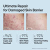 Anti Acne Ceramide Skin Barrier Repair Serum