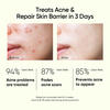 2% Salicylic Acid Face Serum For Repair Skin Barrier