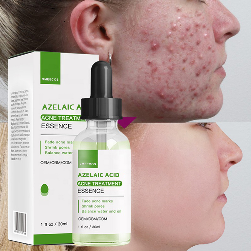  Anti Acne Removal Azelaic Acid Anti-wrinkle Face Serum