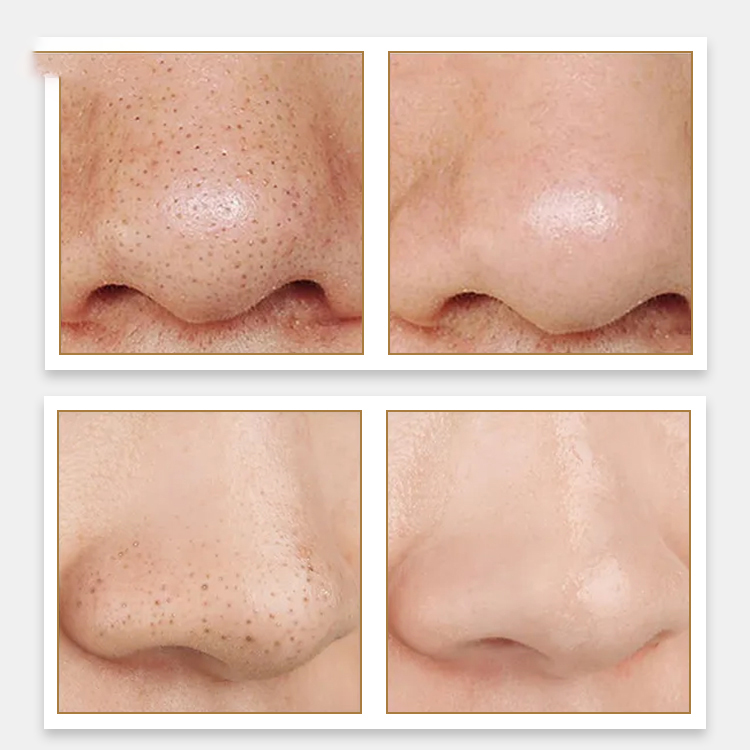  Deep Cleansing Nose Strips Pore Blackhead Removal Peel Off Mask